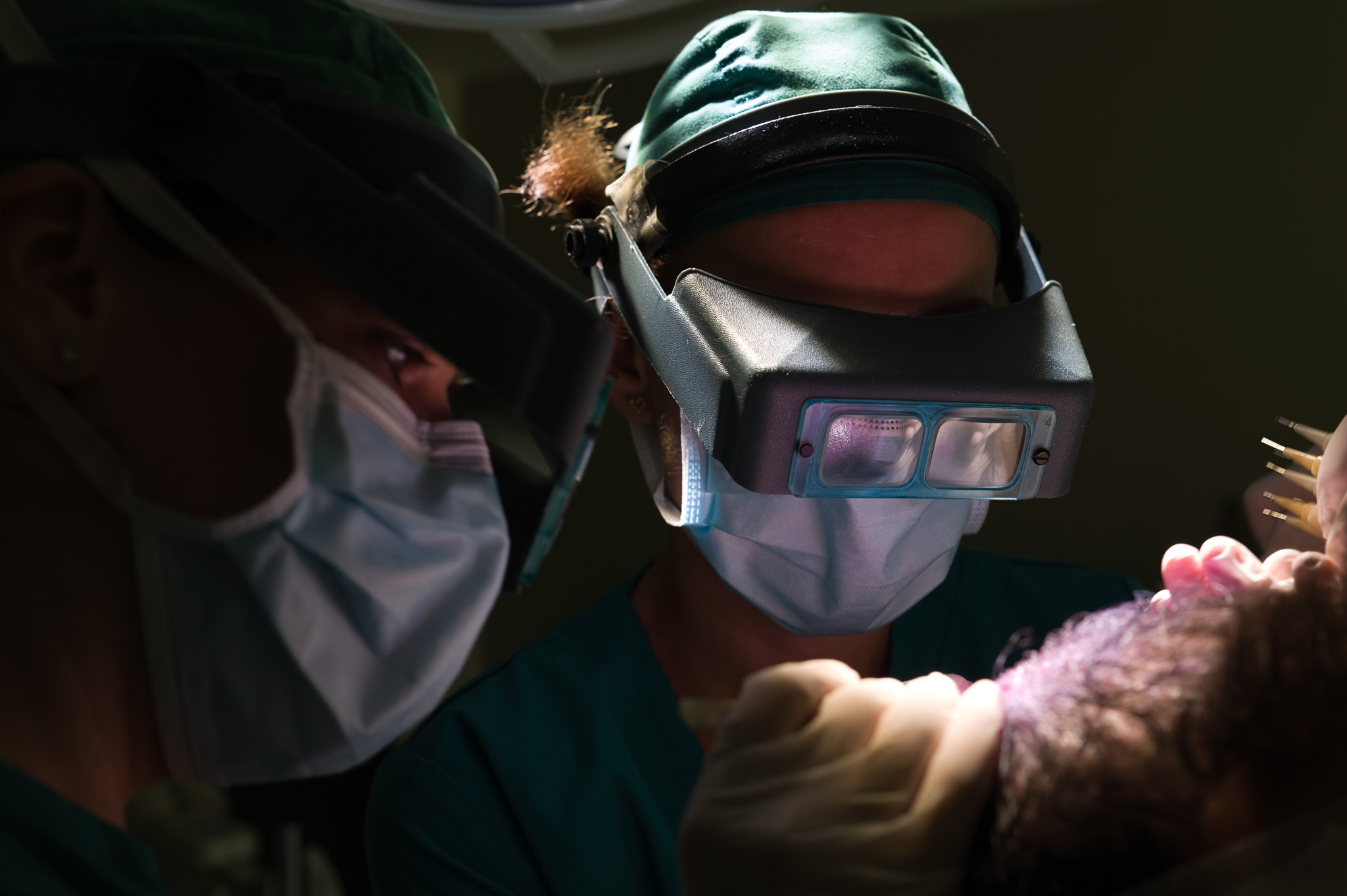Hair transplant surgery procedure showing surgeon with specialized equipment